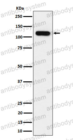 Anti-NOLC1 Antibody (R2F81)