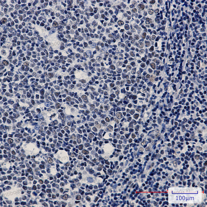 Anti-WTAP Antibody (R2F84)