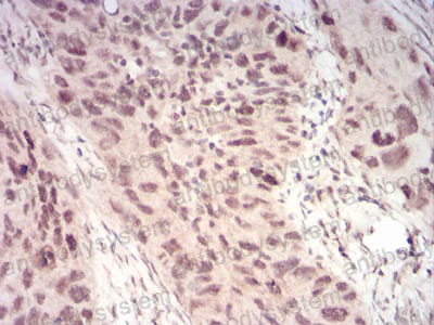 Immunohistochemical for Anti-WTAP Antibody (R3T43) ?>