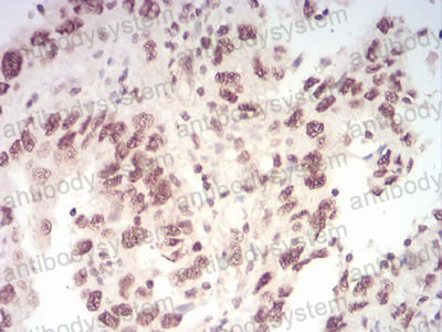 Immunohistochemical for Anti-WTAP Antibody (R3T43) ?>