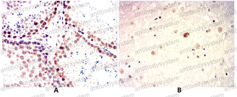 Immunohistochemical for Anti-WTAP Antibody (R3T43) ?>