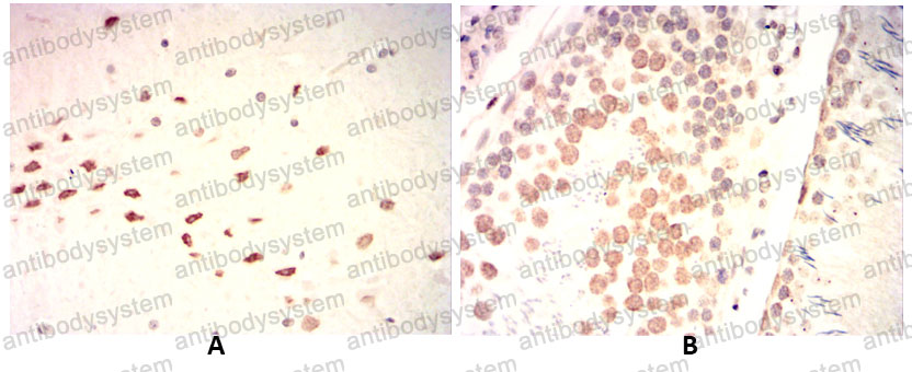 Immunohistochemical for Anti-WTAP Antibody (R3T43) ?>