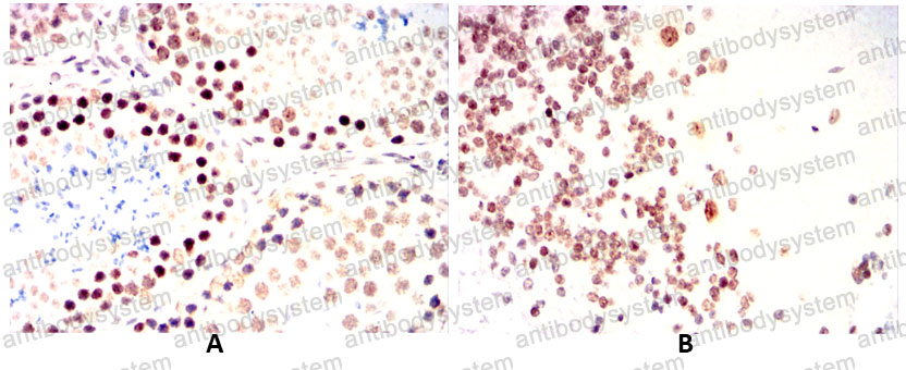 Immunohistochemical for Anti-WTAP Antibody (R3T43) ?>