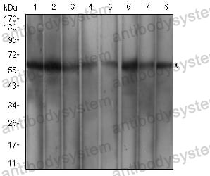 Western blot for Anti-WTAP Antibody (R3T43) ?>