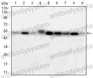 Western blot for Anti-WTAP Antibody (R3T43) ?>