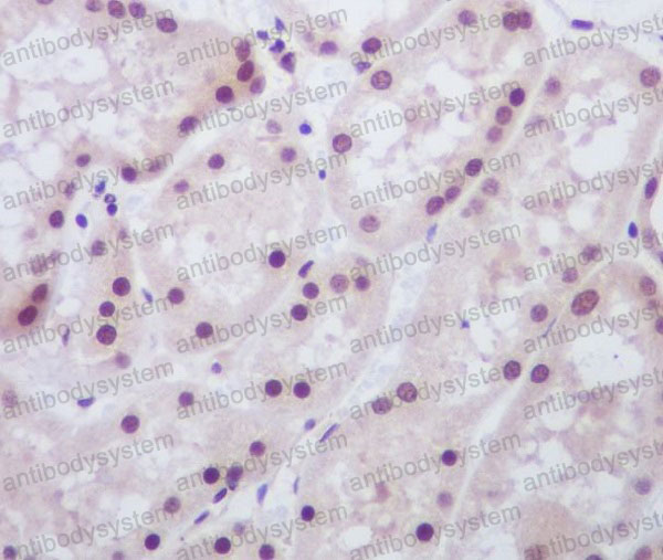 Anti-MAD2L1BP Antibody (R2F85)