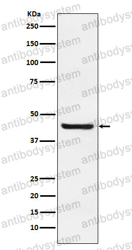Anti-SEPTIN2 Antibody (R2F86)