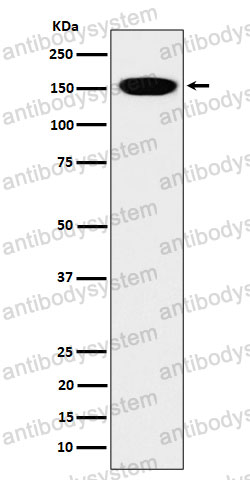 Anti-NCAPD2 Antibody (R2F87)
