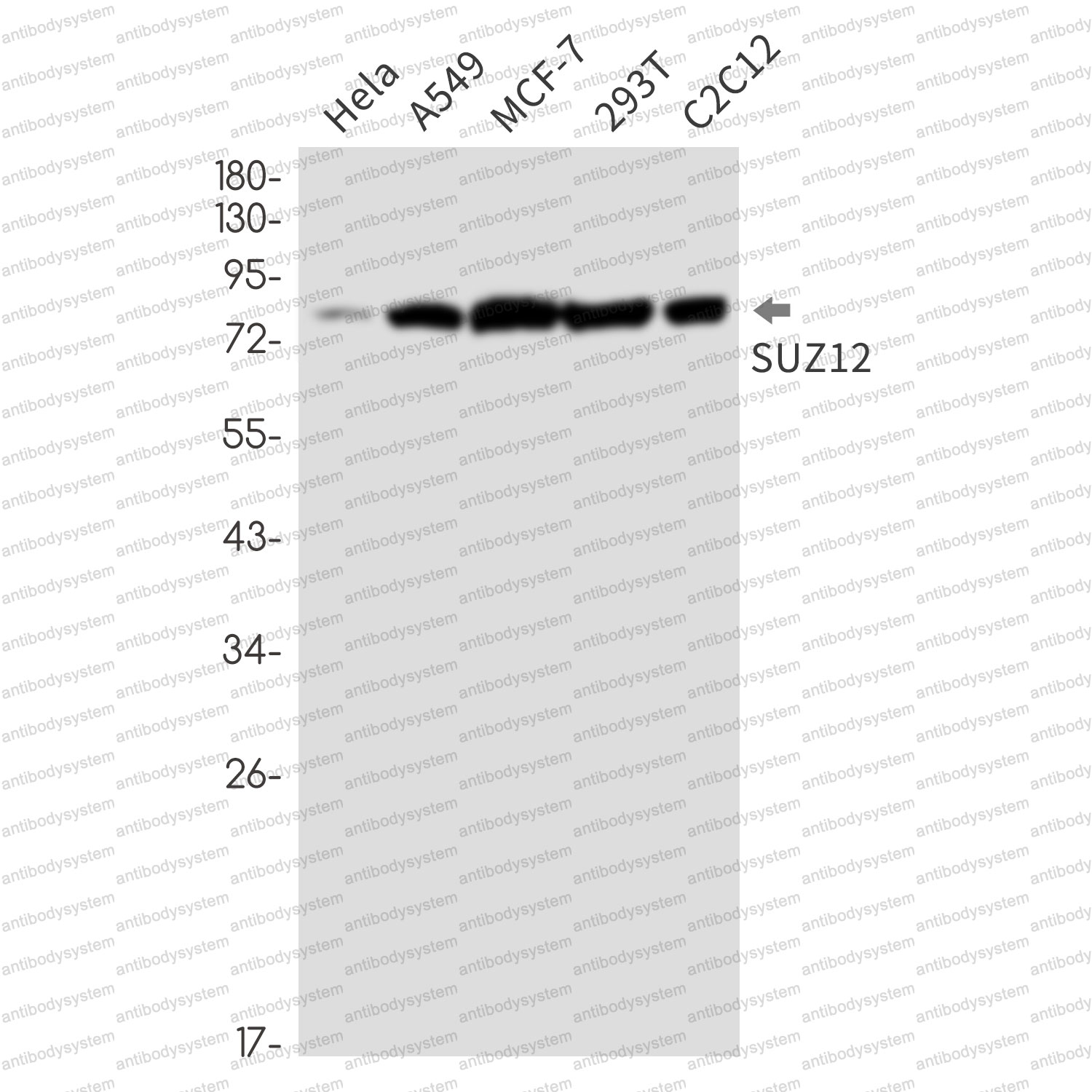 Anti-SUZ12 Antibody (R2F88)