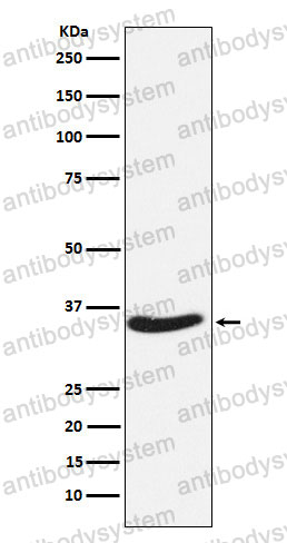 Anti-EXOSC7 Antibody (R2F90)