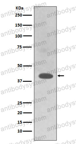 Anti-TRAM2 Antibody (R1A85)