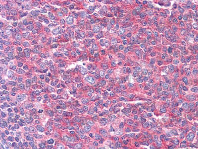 Immunohistochemical for Anti-KARS1/Lysyl-tRNA synthetase Antibody (R3T49) ?>