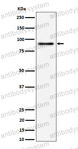 Anti-ACAP2 Antibody (R2F91)