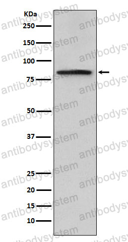 Anti-POSTN/OSF-2 Antibody (R2F93)