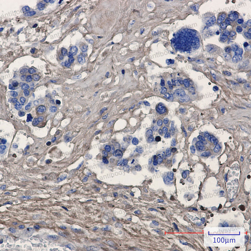 Anti-POSTN/OSF-2 Antibody (R2F94)