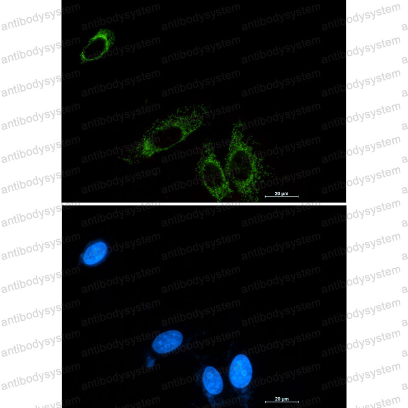 Anti-P2RY6 Antibody (R2F97)
