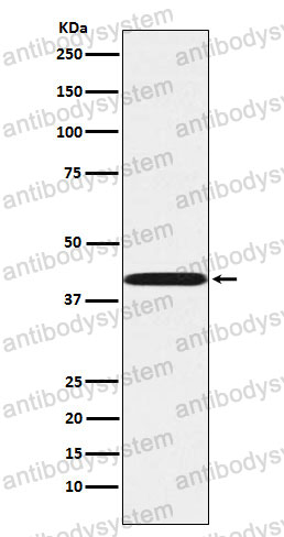 Anti-P2RY6 Antibody (R2F96)