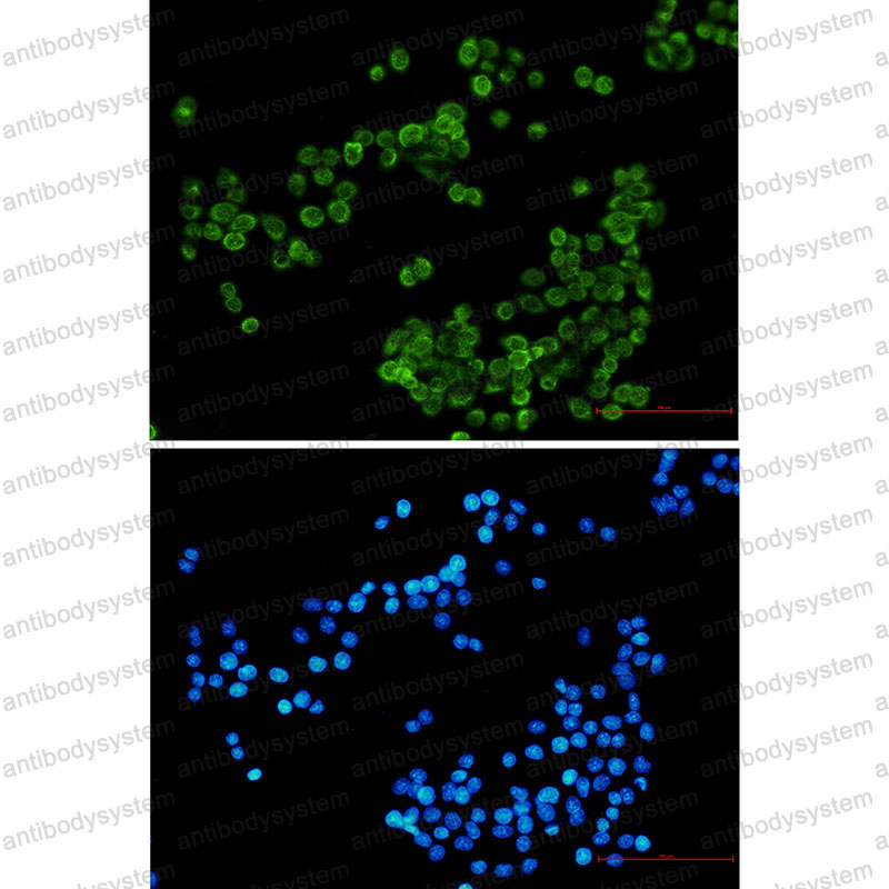 Anti-NCF4 Antibody (R2F99)