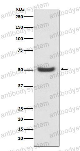Anti-PDIA6 Antibody (R2G01)
