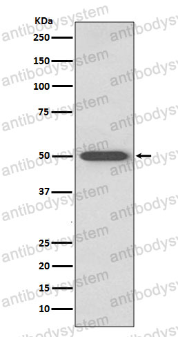 Anti-RAGE/AGER Antibody (R2G02)
