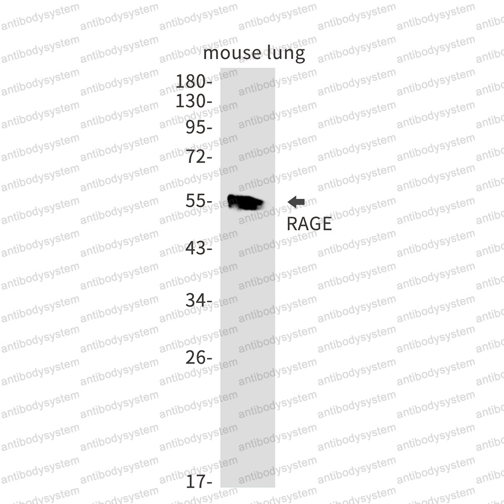 Anti-RAGE/AGER Antibody (R2G03)