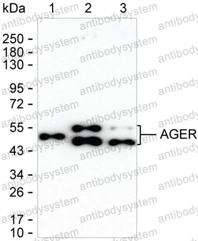 Western blot for Anti-RAGE/AGER Antibody (R3T53) ?>