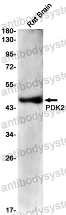 Anti-PDK2 Antibody (R2G04)