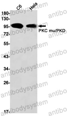 Anti-PRKD1 Antibody (R2G07)