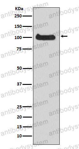 Anti-PRKD1 Antibody (R2G05)