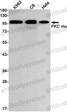 Anti-PRKD1 Antibody (R2G06)