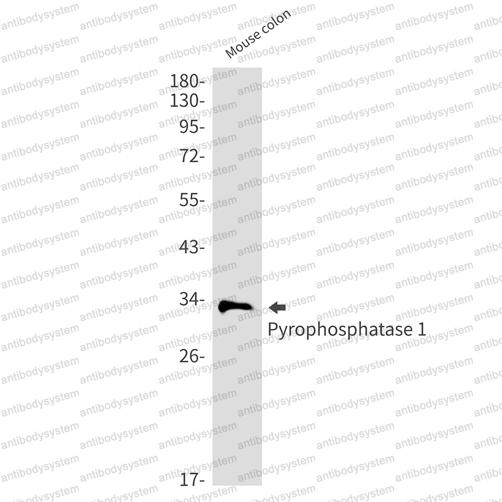 Anti-PPA1 Antibody (R2G11)