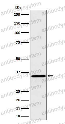 Anti-PPA1 Antibody (R2G10)