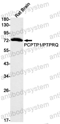 Anti-PTPRR Antibody (R2G17)