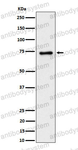 Anti-PTPRR Antibody (R2G16)