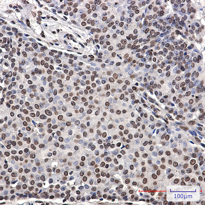 Anti-Phospho-ERBB4/Her4 (Tyr1162) Antibody (R2G18)