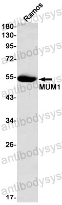 Anti-IRF4 Antibody (R2G22)