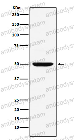 Anti-IRF4 Antibody (R2G20)