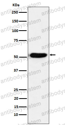 Anti-IRF4 Antibody (R2G21)
