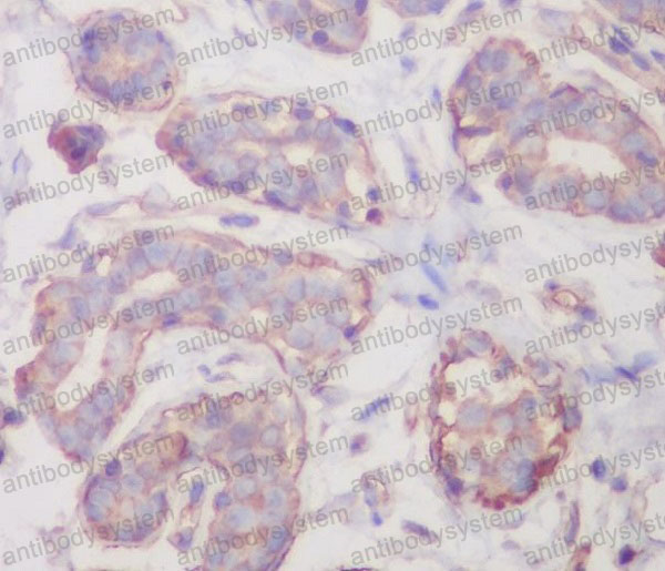 Anti-RALBP1 Antibody (R2G23)
