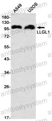 Anti-LLGL1 Antibody (R2G24)