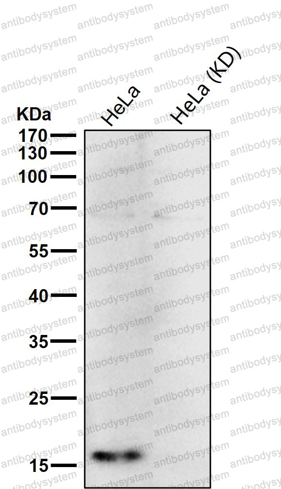 Anti-ELOB Antibody (R1B16)