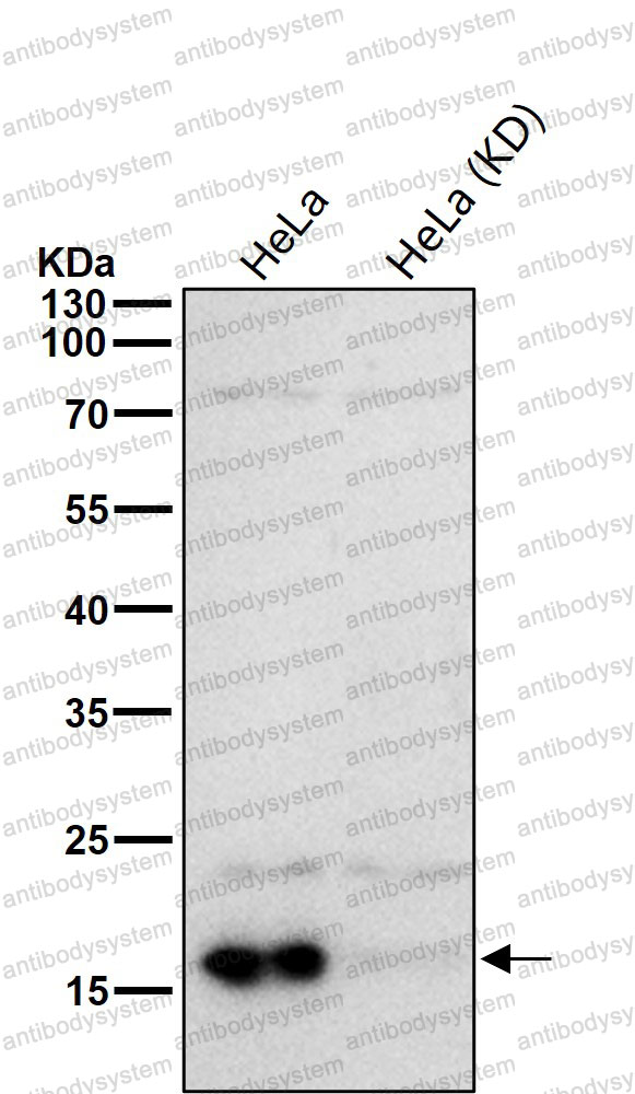 Anti-ELOB Antibody (R1B17)