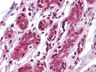 Immunohistochemical for Anti-EPHA7 Antibody (R3T68) ?>