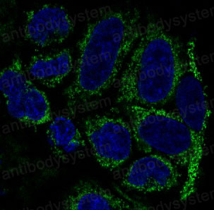 Anti-TOMM20 Antibody (R1C36)