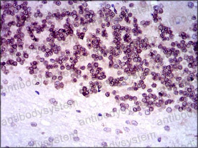 Immunohistochemical for Anti-NR6A1 Antibody (R3T74) ?>