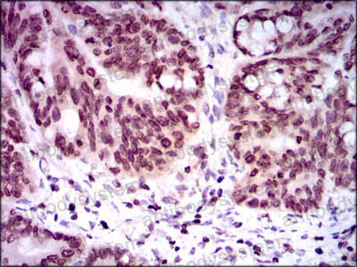 Immunohistochemical for Anti-NR6A1 Antibody (R3T74) ?>