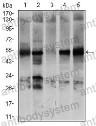 Western blot for Anti-NR6A1 Antibody (R3T74) ?>