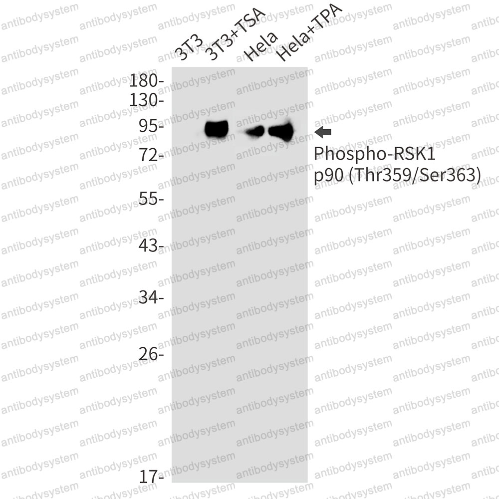 Anti-Phospho-RPS6KA1 (Thr359/Ser363) Antibody (R2G35)