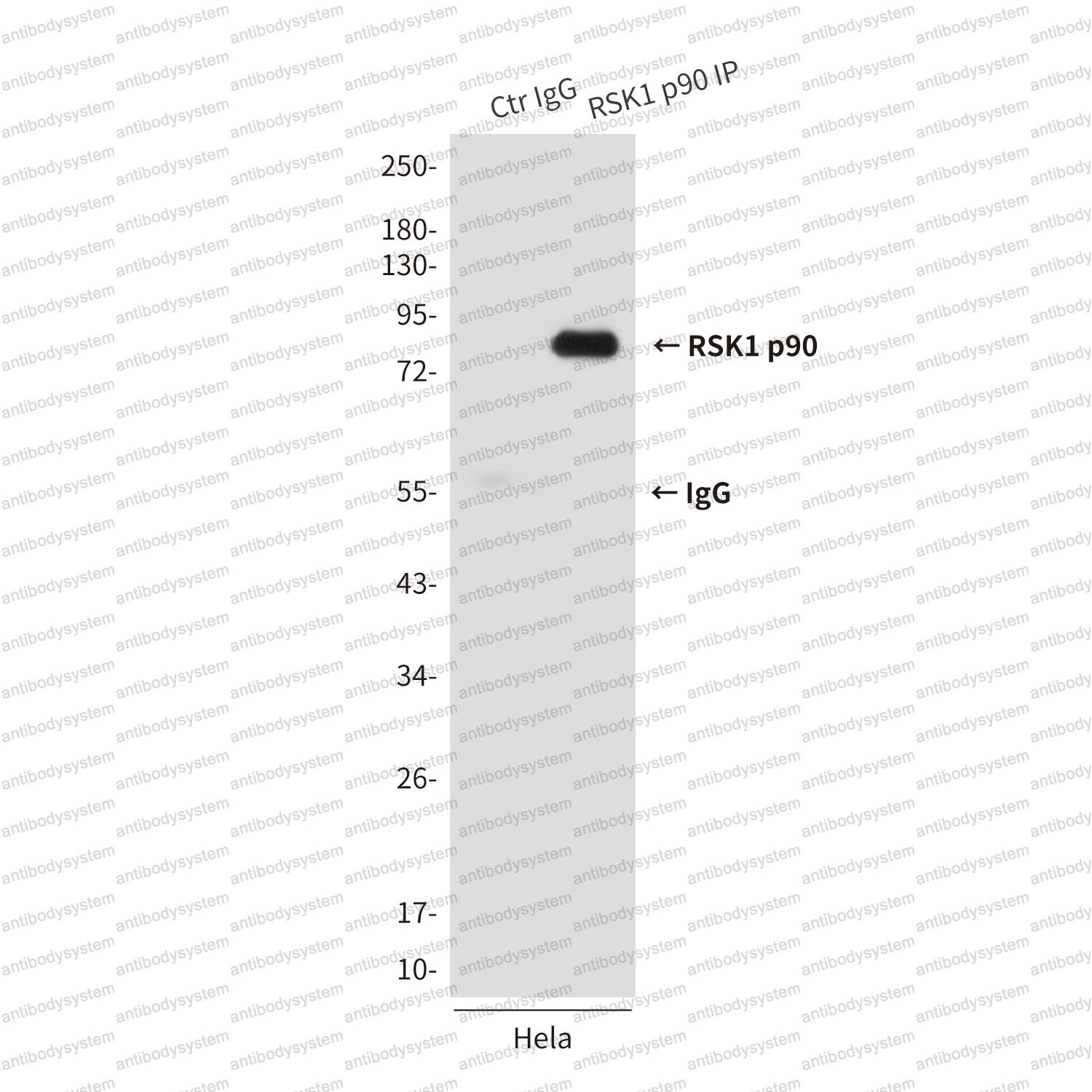 Immunoprecipitation for Anti-RPS6KA1 Antibody (R3T78) ?>