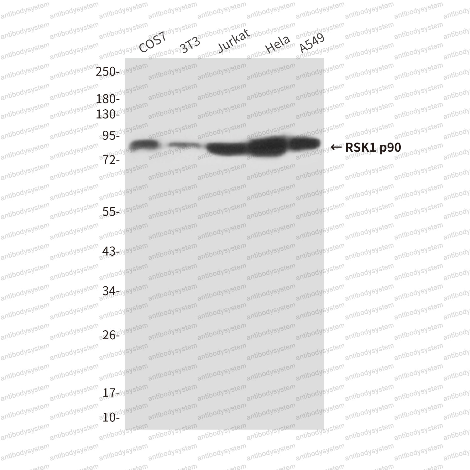 Western blot for Anti-RPS6KA1 Antibody (R3T78) ?>